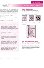 Breast Health Facts for Life - What is Breast Cancer